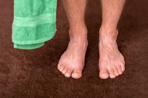 Toenail Fungus How to Prevent It