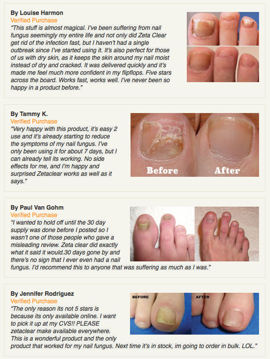 Toenail case study